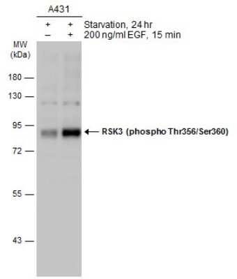 Western Blot: RSK3 [p Thr356, p Ser360] Antibody [NBP3-13247]
